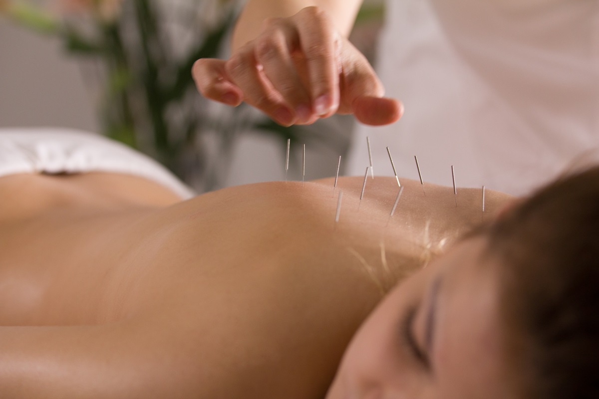 Les meilleurs acupuncteurs de Vevey